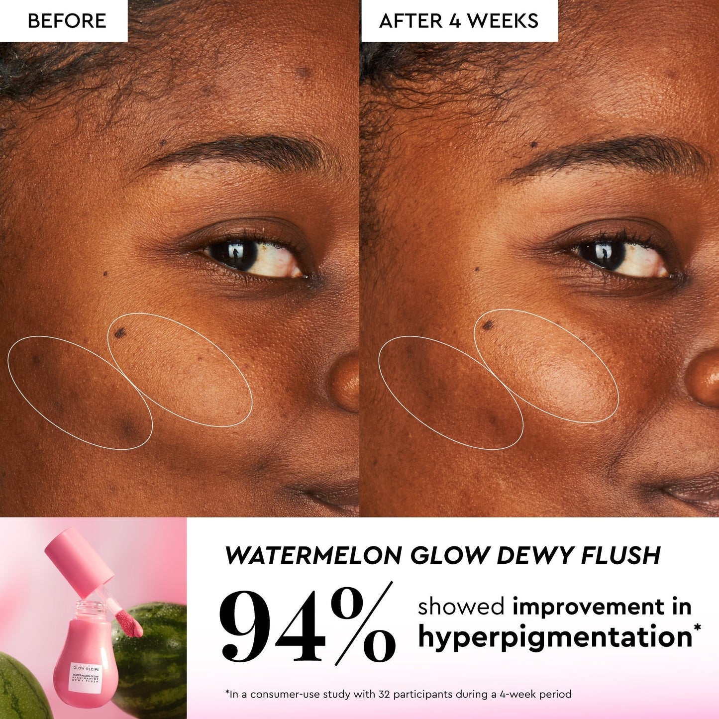 Watermelon Glow Best-Sellers Kit