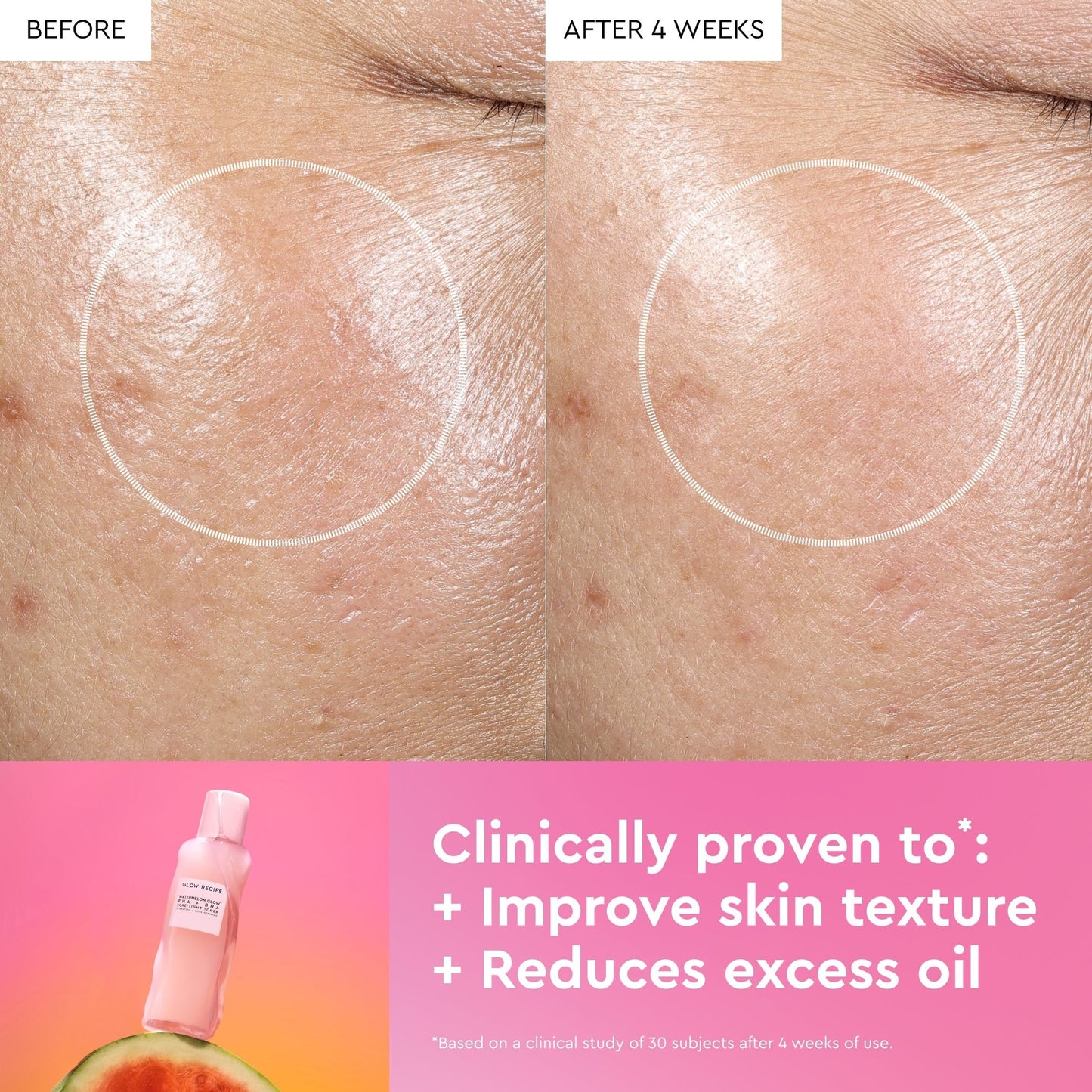 Watermelon Glow PHA+BHA Pore-Tight Toner