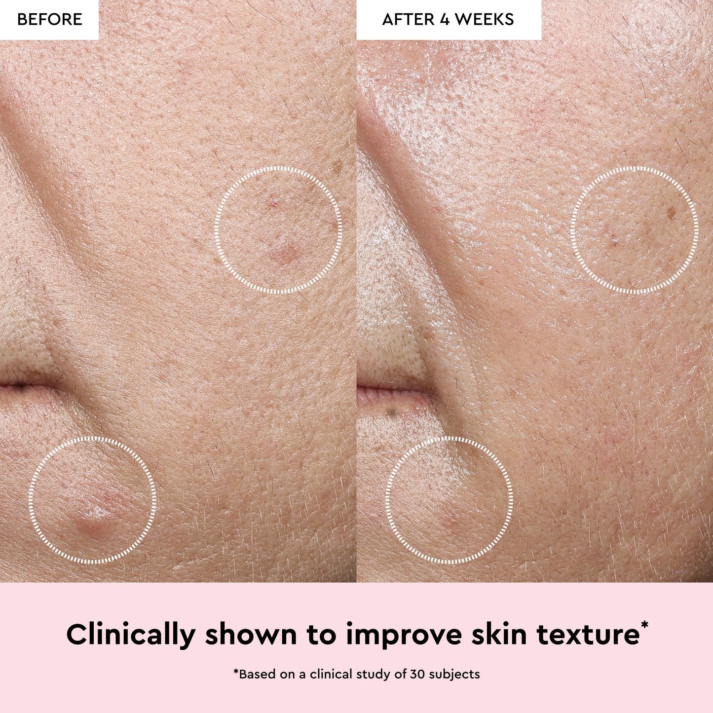 Watermelon Glow Niacinamide Dew Drops