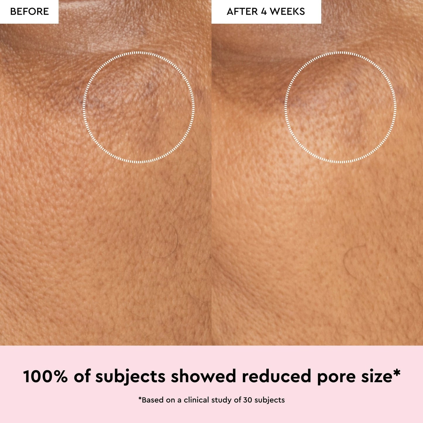 Watermelon Glow Niacinamide Dew Drops