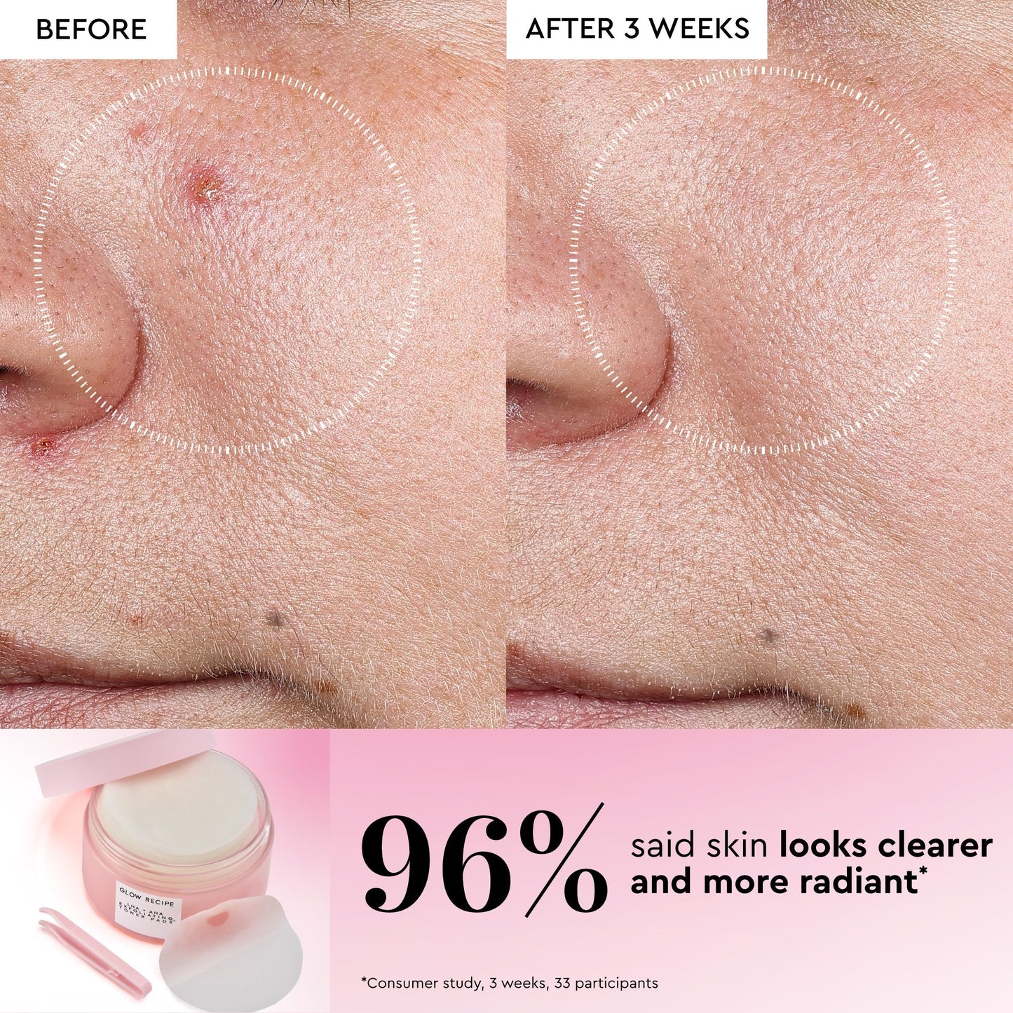 LHA + AHA Korean Watermelon Toner Pads