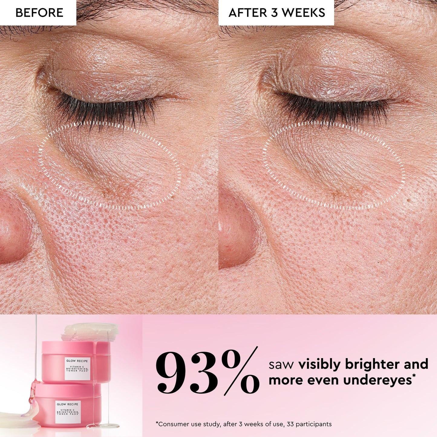 Vitamin C Brightening Korean Toner Pads