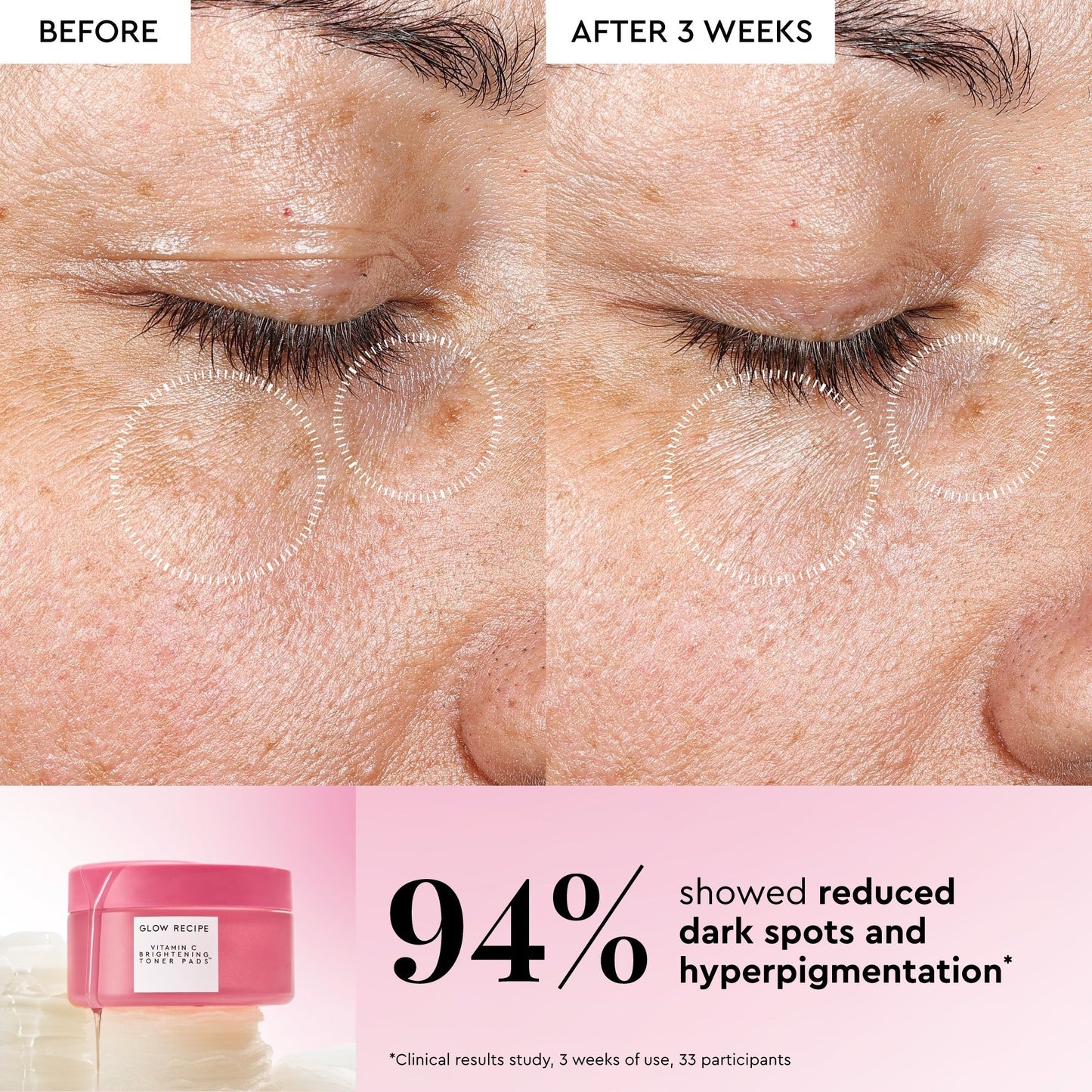 Vitamin C Brightening Korean Toner Pads