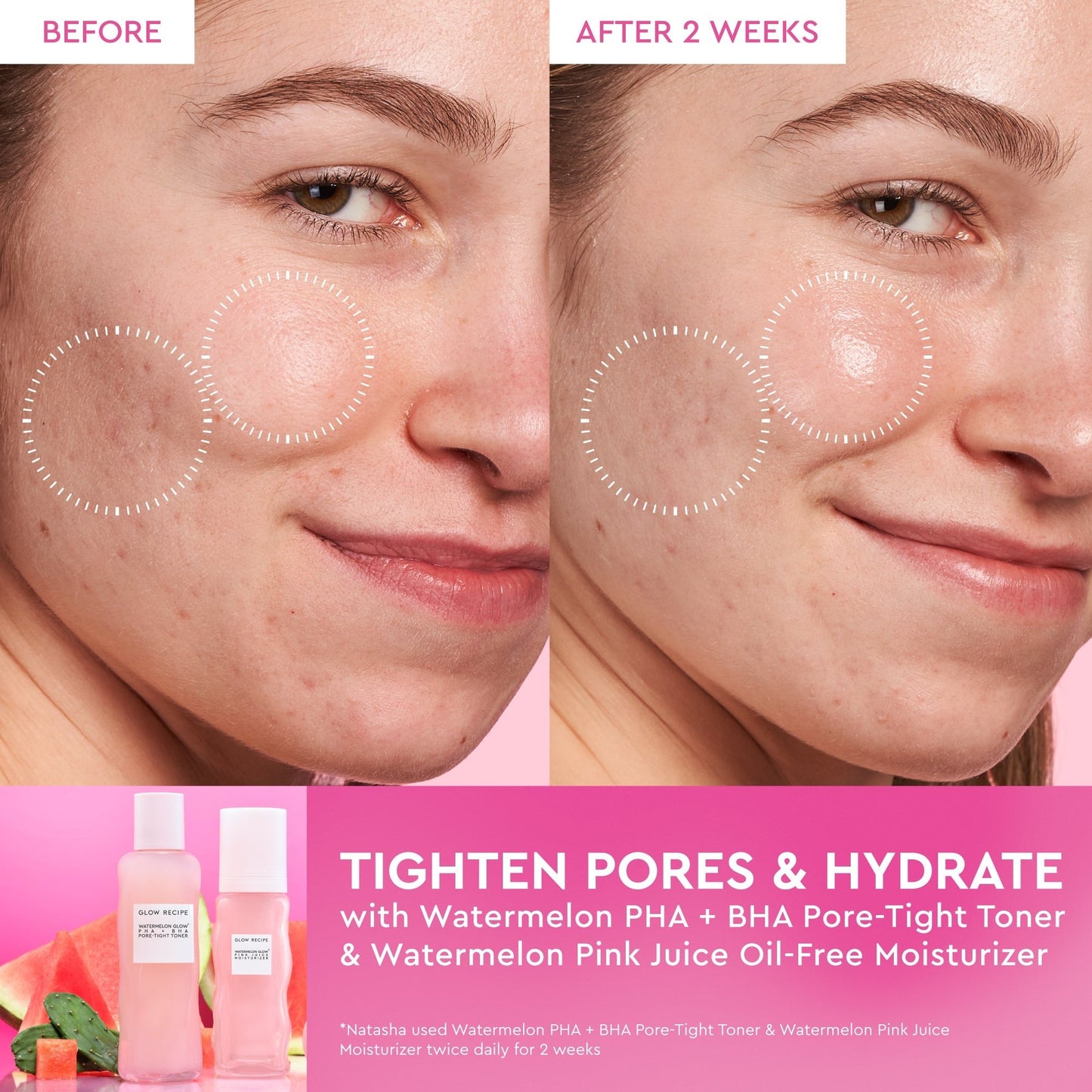 Watermelon Glow Dewy Skin Routine