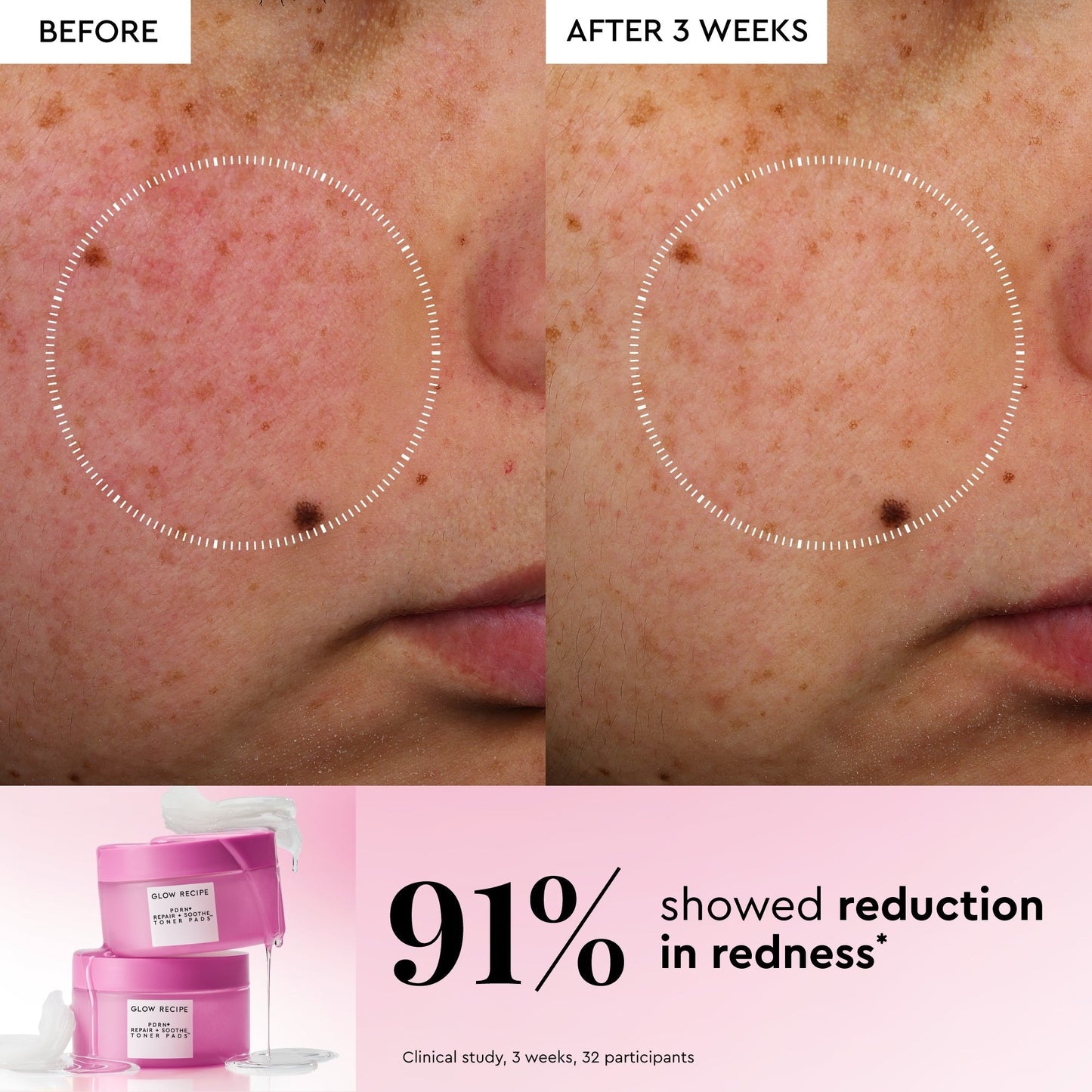 Korean Toner Pad Collection Trial Set